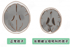 婴幼儿身高体重测量仪厂家:万万没想到,“吼孩子”竟然影响长高,再也不敢了！9.1